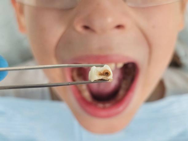 Best Walk-In Emergency Dental Services in Salineville, OH